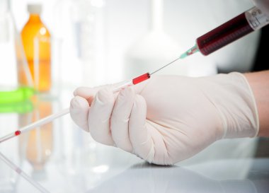 tüp izole mavi sıvı ile