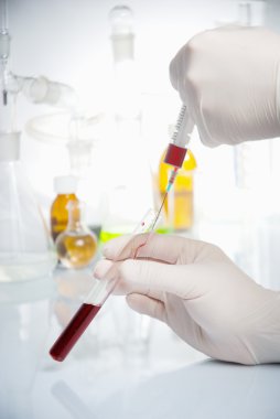 tüp izole mavi sıvı ile