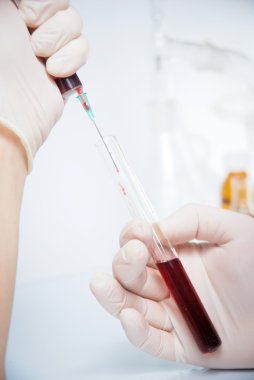 tüp izole mavi sıvı ile