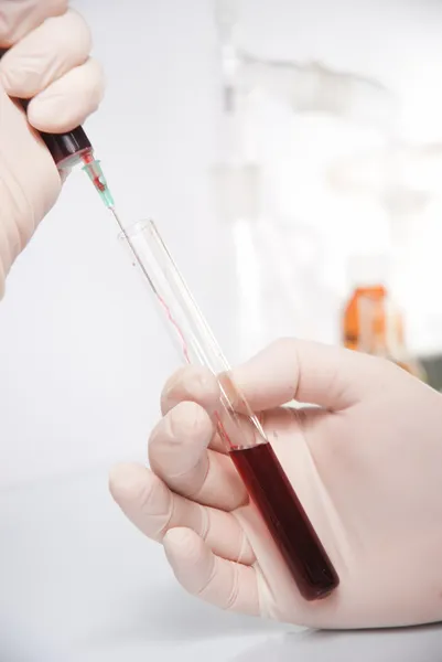 Test-tube with blue liquid isolated — Stock Photo, Image