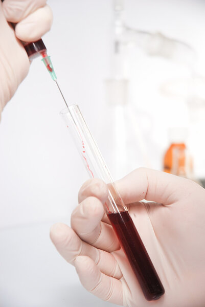 Test-tube with blue liquid isolated