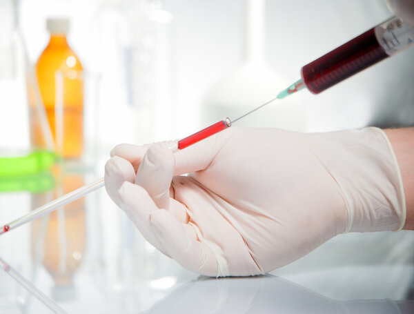 Test-tube with blue liquid isolated