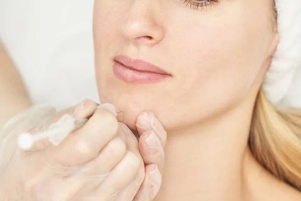 Spritze im Wellness-Salon. Der Arzt legt Handschuhe an. Nahaufnahme. Hübsche Patientin — Stockfoto