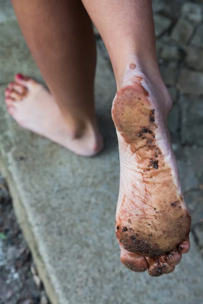 Woman with dirty feet