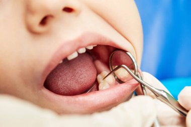 Pediatrik dişçi küçük dişleri kontrol ediyor.