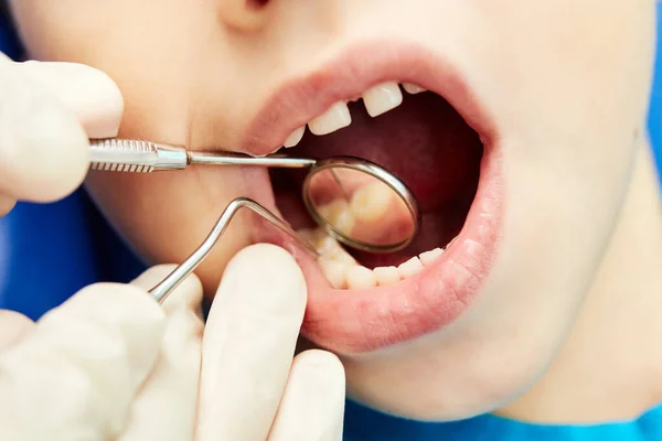Pediatrisk Tandläkare Kontrollerar Tänderna Hos Liten — Stockfoto