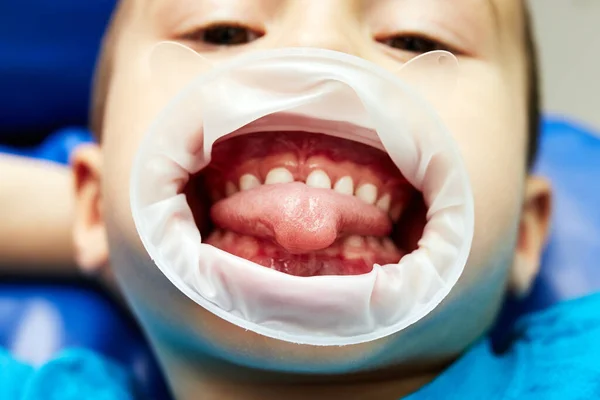 Menino Cadeira Dentista Mostra Dentes Engraçados Sorrindo Olhando Para Câmera — Fotografia de Stock