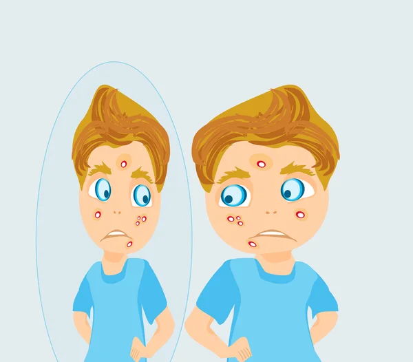 Boy in puberty with acne — Stock Vector