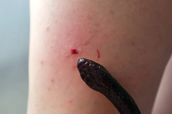 Venomous Snake Bite Man Leg Close — Stockfoto