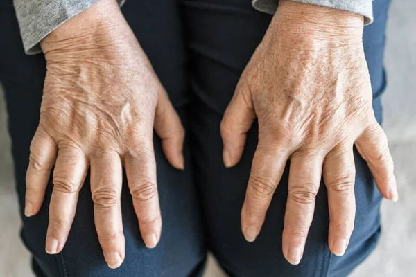 Seniorin Hause Leidet Arthritis — Stockfoto