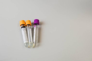 laboratuvar test tüpleri Bilim Araştırma Lab.