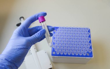 Koruyucu eldivenlerde doktorun elinde sıvı test tüpü var. Sonuçların analizi ve incelenmesi kavramı.