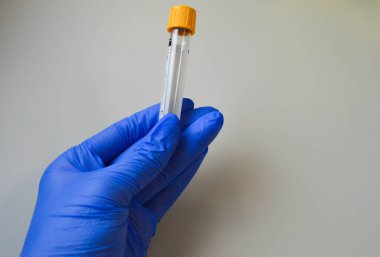 cam tüp tıbbi test sırasında bilim adamı elinde mavi akışkan ile yakın çekim.
