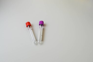 Laboratuvar tıbbi test tüpleri masada..
