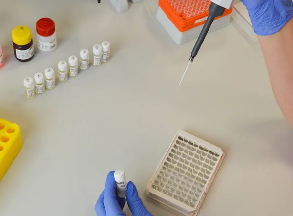 Hand Van Een Wetenschapper Met Kolf Met Laboratoriumglaswerk Reageerbuizen Chemische — Stockfoto