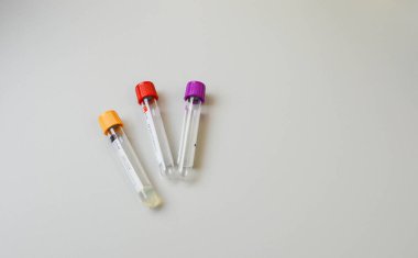 Modern laboratuarın masasında test tüpleri ve numuneler var..