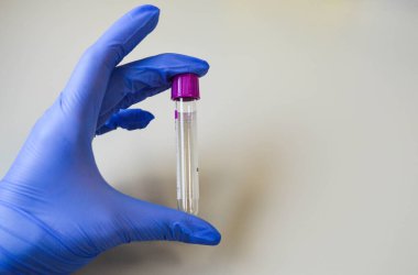 Eldivenli doktor koronavirüse karşı aşı tutuyor..