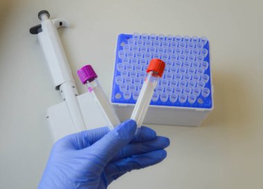 Koronavirüs antikorları için pozitif test. 19. bölge nüfusunun dokunulmazlığını kontrol ediyorum. Laboratuvar araştırmalarının arka planına karşı bir doktorun elinde kan testi olan bir test tüpü..