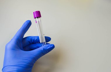 Eldivenli bir el Covid-19 test tüpü kullanıyor..