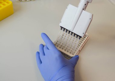 Değişken hacimli tek kanallı dağıtıcı. Tıp çalışanı, bilim adamı, kauçuk eldivenli laboratuvar asistanı laboratuarda çalışıyor..