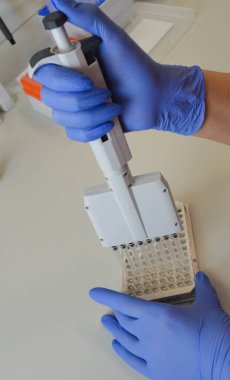 Laboratuvarda kan testi. Dispanser ile çalışan laboratuvar asistanı. Kanlı vakum tüpleri..