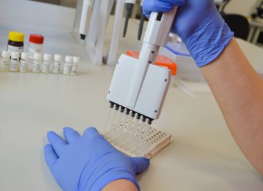 Bakteri ve virüslere, antibiyotiklere ve aşılara karşı ilaçları doldurmak için otomatik sıvı dağıtıcının tepsisinde üretilen cam şişeler..