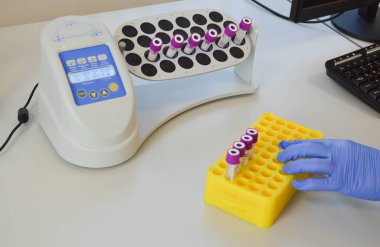 Coronavirus COVID-19 Pozitif Test.