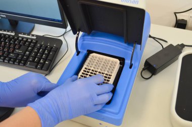 Mavi steril eldivenli bir doktor çalışma yapmak için aparata bir reaktör ile bir tabak koyar. Laboratuvar analizcisi. venöz kan testi.