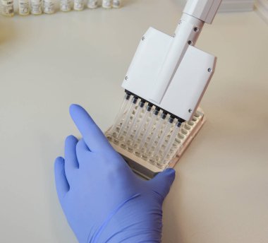 Enzim immünoassay ile laboratuvar analizi yapıyorlar. Damardan bir kan testi. Sıvıları taşımak için taşınabilir pipet. Sıvı medya işleme sistemi. laboratuvar teşhisleri.