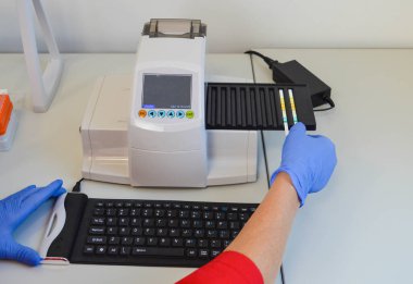 Analizci otomatikman idrar araştırmaları için. Biyolojik materyallerin teşhisi için şeritler. Laboratuvar ekipmanları üzerinde idrar analizi çalışması, doğru sağlık teşhisleri.