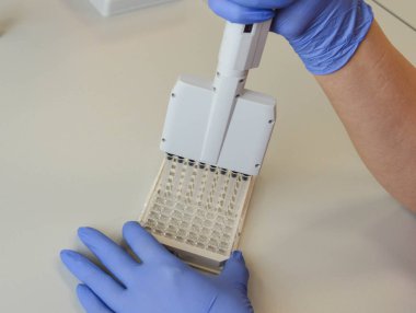 Laboratuvar testleri için mekanik dağıtıcı. Kan testleri için ipuçları. ELISA tarafından testler için malzeme ayarlamak.