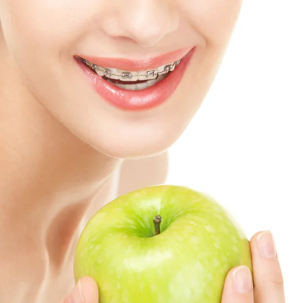 Girl in braces with green apple on white background — Stock Photo, Image