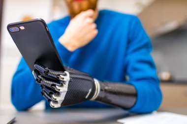 Biyonik elli genç adam evde mutfak arka planında otururken akıllı telefonu tutuyor.