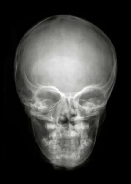 Head from front — Stock Photo, Image