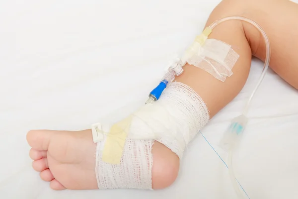 Bandage on baby leg — Stockfoto