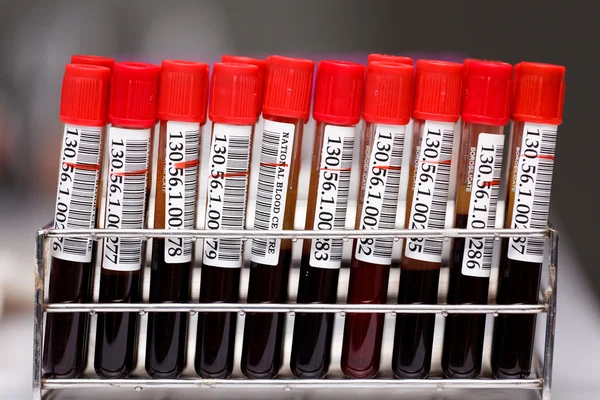 Tubos de sangue da amostra em laboratório — Fotografia de Stock