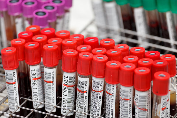 Sample blood tubes in laboratory