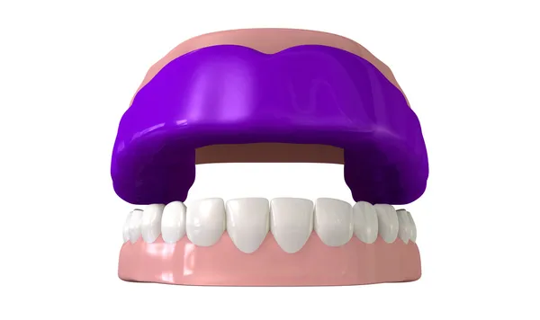 Guma osłony zamontowane na otwarte fałszywych zębów — Zdjęcie stockowe