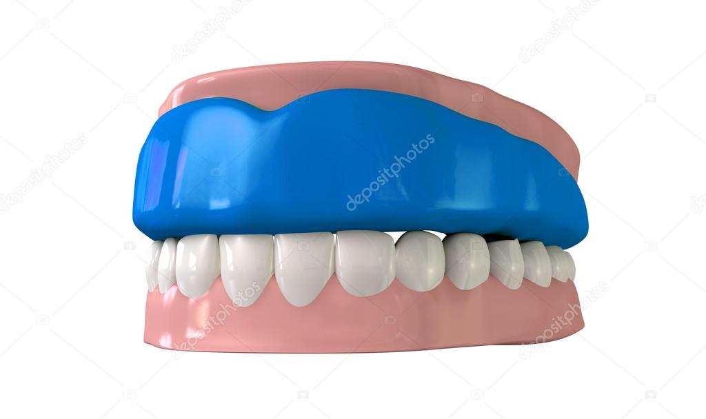Gum Guard Fitted On Closed False Teeth