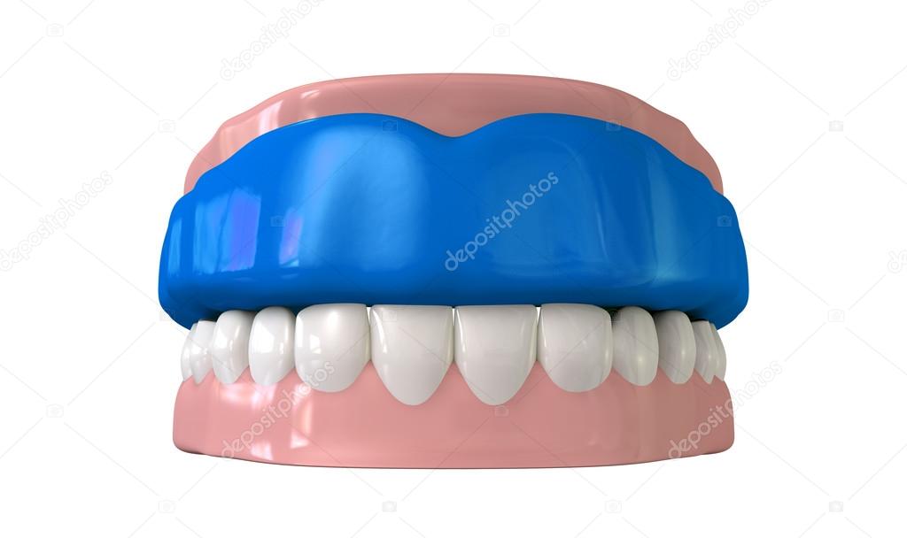 Gum Guard Fitted On Closed False Teeth