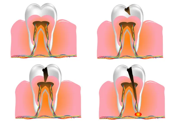 牙的结构 — 图库矢量图片