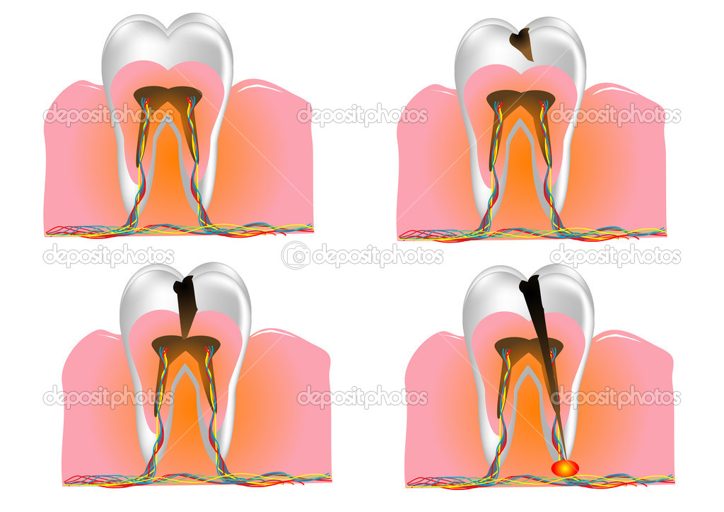 structure of the tooth