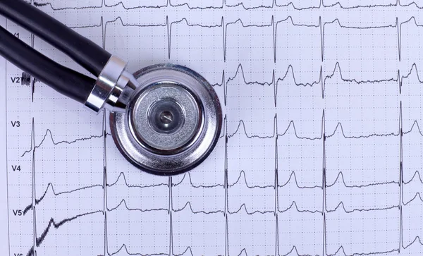 Stetoscopio ed ECG — Foto Stock