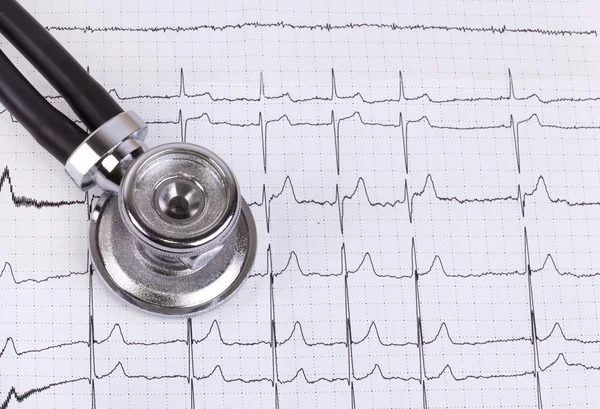 Stethoskop und Ekg — Stockfoto