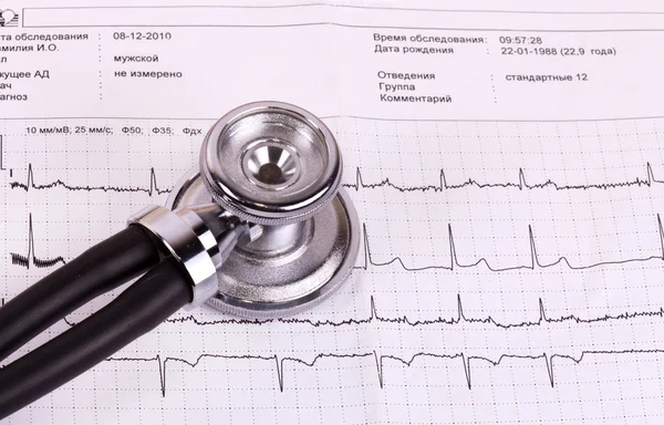 Stetoscopio ed ECG — Foto Stock