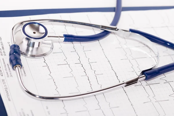 Stetoscopio sugli appunti con ecg — Foto Stock