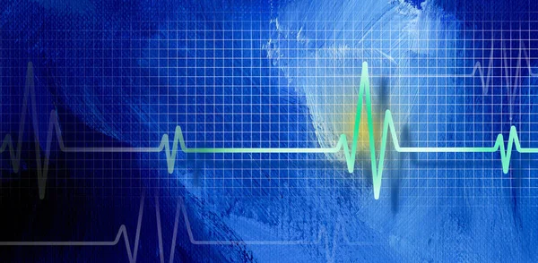 Grafisk Design Medisinsk Ekg Hjerteslag Mot Abstrakt Penselstrøk Teksturert Bakgrunn – stockfoto