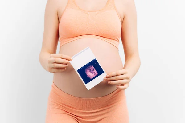 出生前超音波検査 お腹の中に生まれたばかりの赤ちゃんのソノグラムを抱えている若い妊婦のクローズアップ 胎児超音波画像を示す幸せな期待の母親 — ストック写真