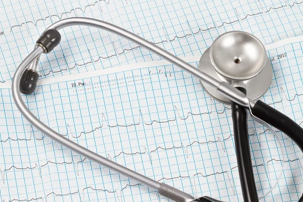 Estetoscopio y gráfico ECG —  Fotos de Stock