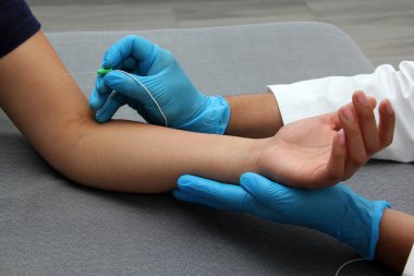 Electromyography is a graphic recording technique of the electrical activity of the muscles known as electromyogram or EMG, it is monitored through intramuscular electrodes